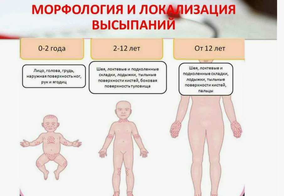 Фотография взята из источника yandex.ru