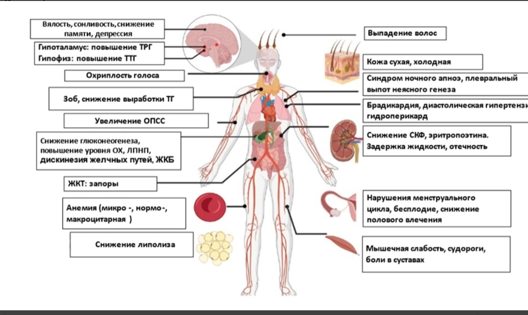 Симптомы гипотиреоза