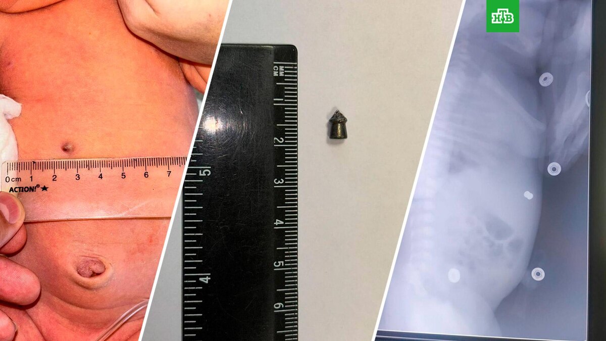    Фото: mocomd_lub / t.me