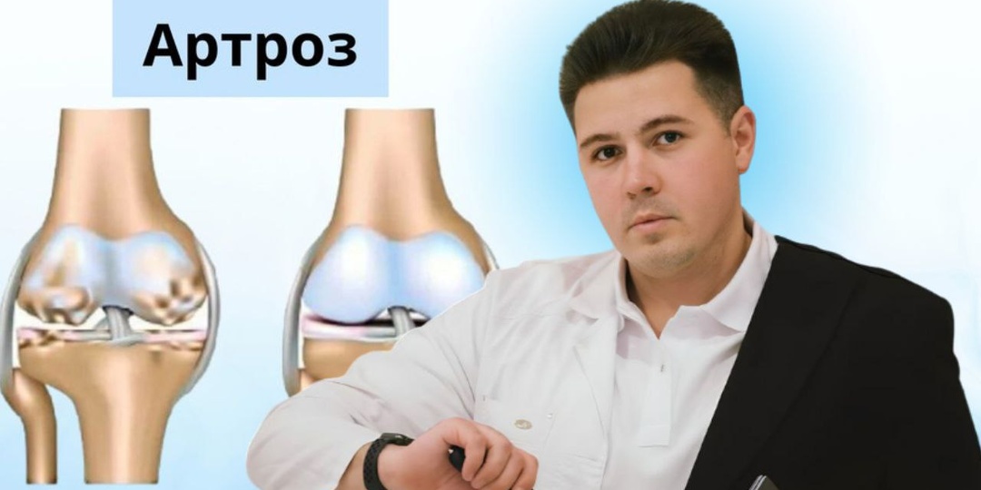 6 правил при артрозе: что стоит делать и что стоит избегать