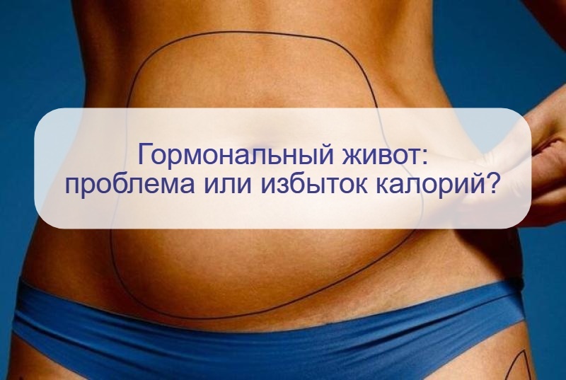 Гормональный живот у женщины: правда ли это эндокринная проблема или нужно меньше есть?