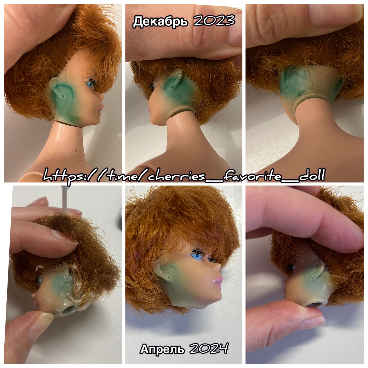 Периодическое нанесение базирона, чередование с другими средствами, не ускорили процесс. 