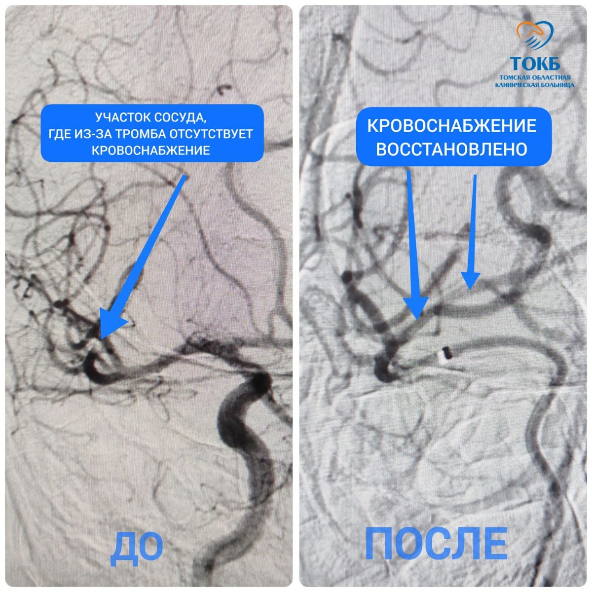 Сосуды головного мозга на снимках 