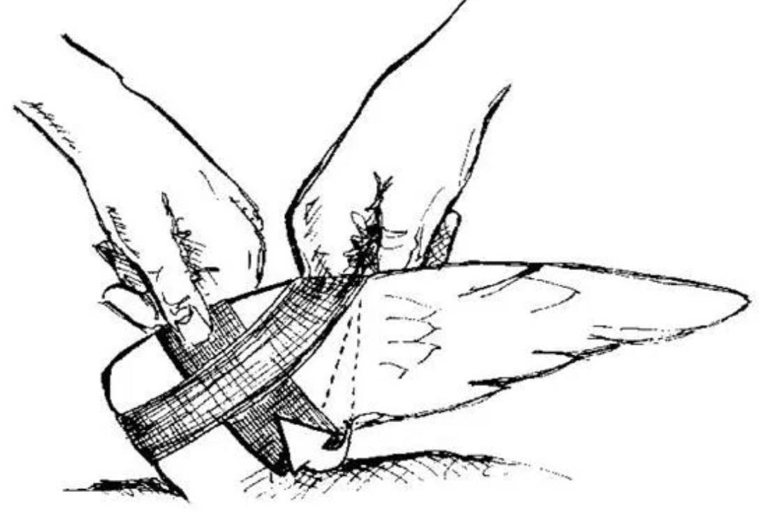 Сломанное крыло как пройти. Сломанное крыло как пройти. Сломанное крыло как пройти. Крылья стрижа. Сломанное крыло как пройти.
