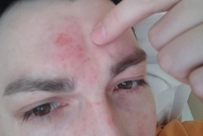 Валентин Гордеев несколько дней провел в больнице после дорожного конфликт
