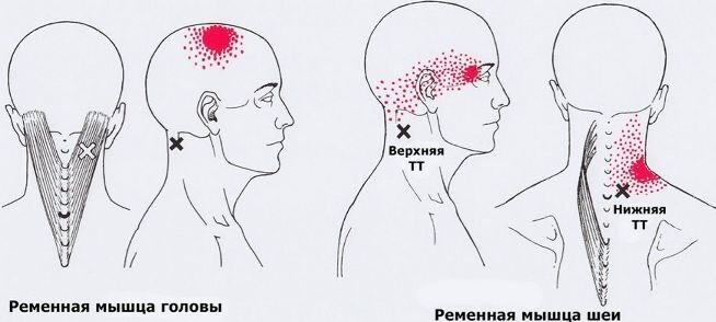 Pic1 Изображение из открытых источников