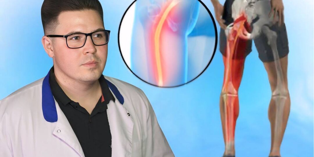 Боль в пояснице, отдающая в ногу? Виноват седалищный нерв. 4 упражнения, которые помогут снять спазм и облегчить боль