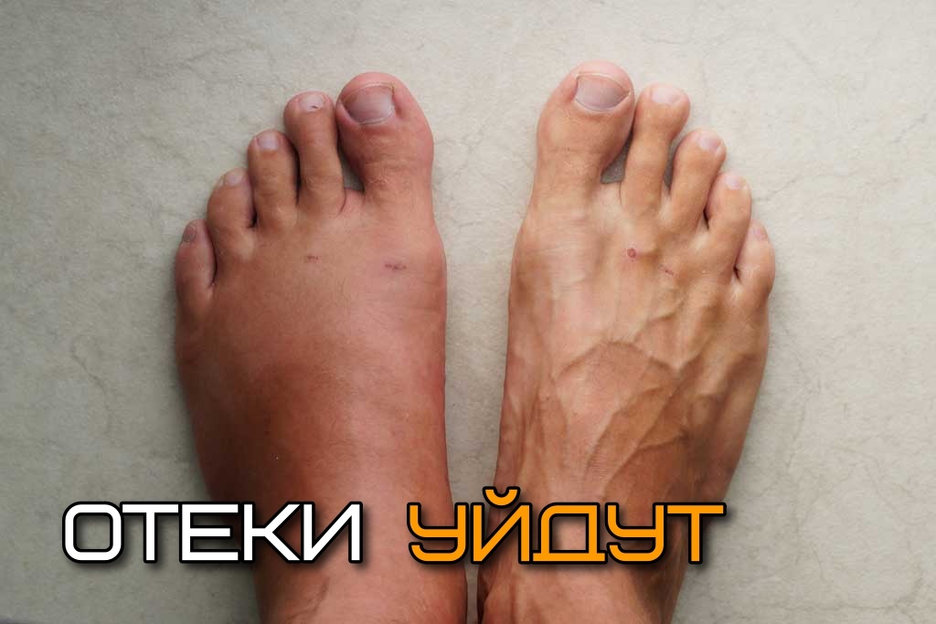 Отеки уходят, тело худеет, лицо молодеет: индийские упражнения для ног 