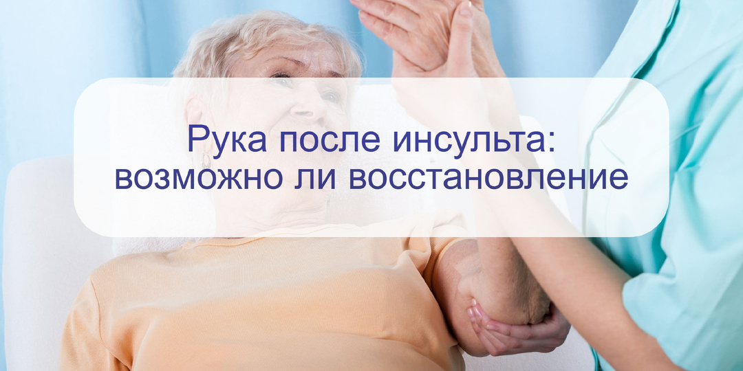 Возможно ли полное восстановление паралича руки после инсульта: мнение врачей