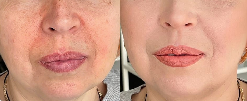 Клиентки 50+ как видят свою кожу, расспрашивают, что же я такое использовала: 3 белорусских средства