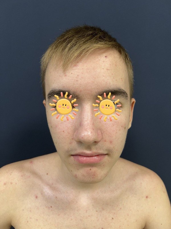 До лечения. Фото с приёма доктора Меньщиковой