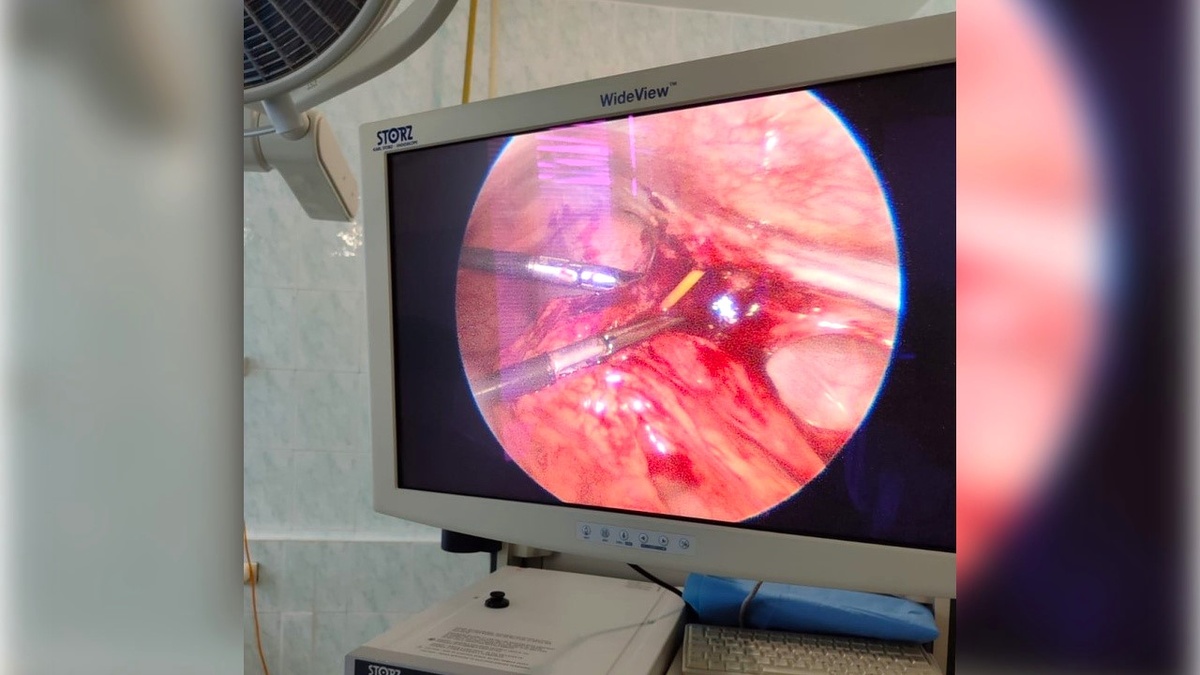    Сургутские хирурги достали зубочистку из брюшной полости подростка