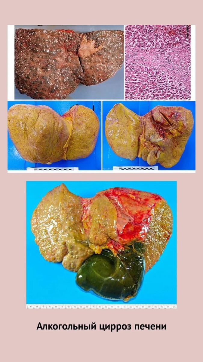 Фото из интернета