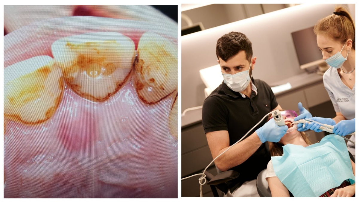 Вот такие фотографии, сделанные прямо на кресле, выводят на экраны. Как тут не согласиться?