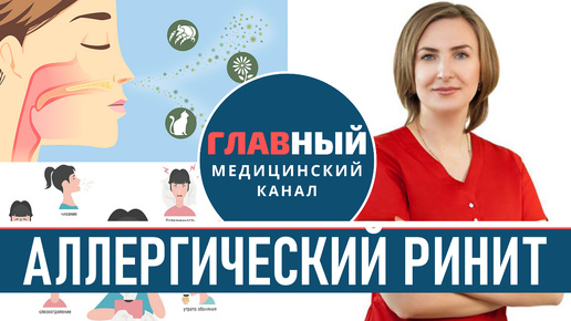 Аллергический РИНИТ: симптомы и причины. Как избавиться от аллергического ринита