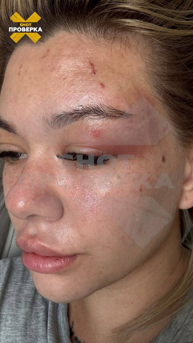 Листайте вправо, чтобы увидеть больше изображений