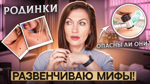 Опасны ли родинки? Развенчиваю мифы!