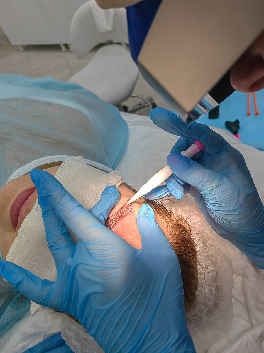 Процесс восстановления густоты бровей 