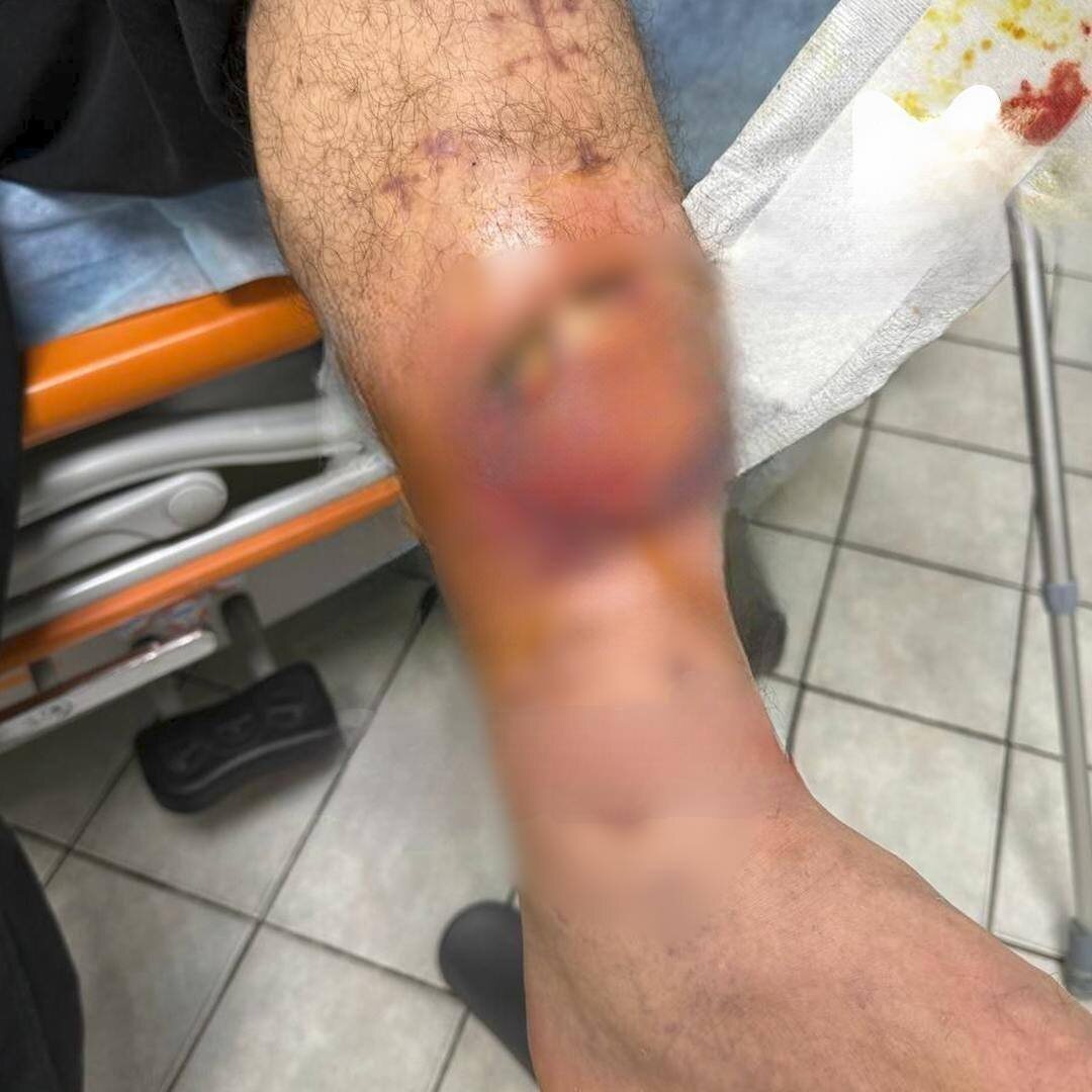 Та самая нога....