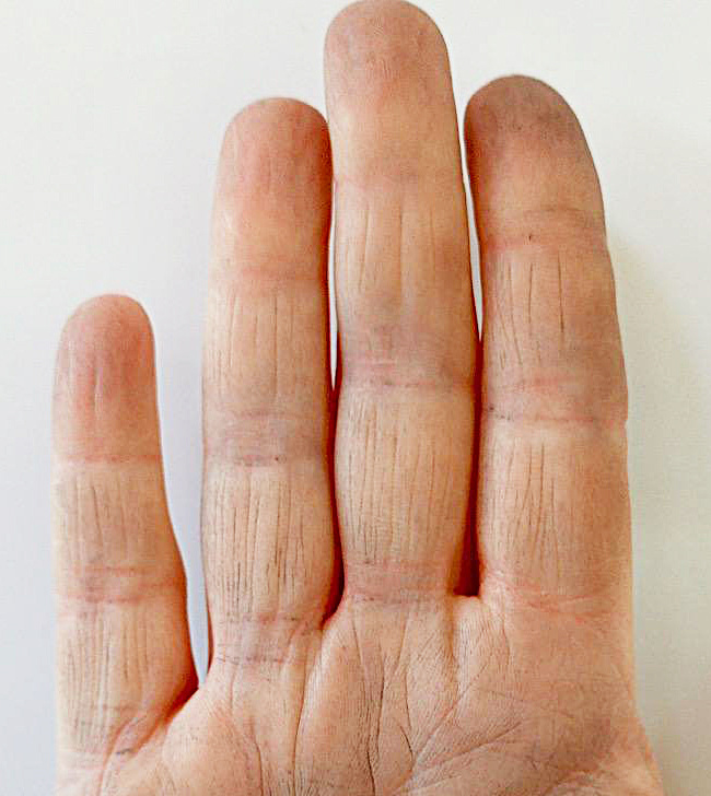 Вертикальные линии на пальцах
