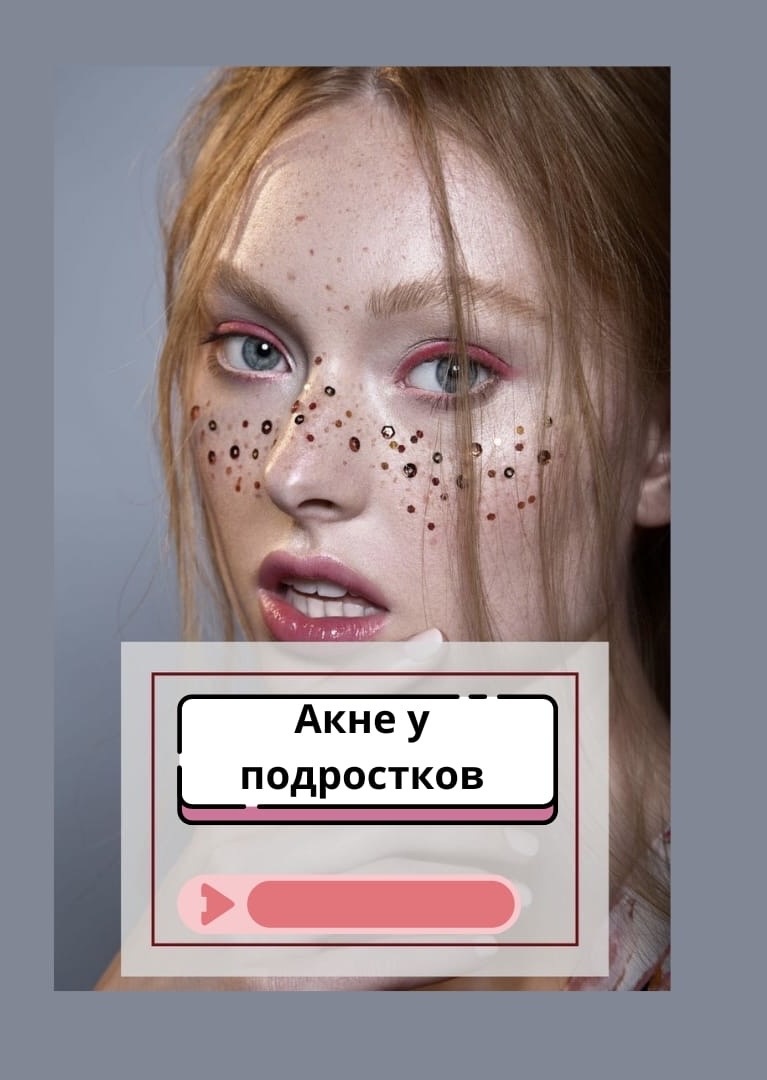 Прыщи у подростков: почему появляются и как лечить?