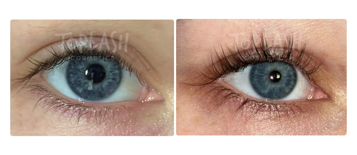 ДО и ПОСЛЕ сыворотки TOPLASH
