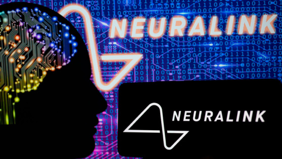    Neuralink успешно установила мозговой имплант второму пациенту Сергей Бунеев