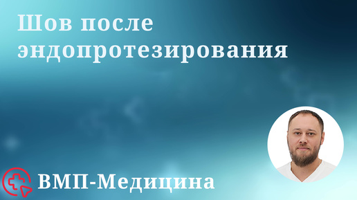 Шов после эндопротезирования | ВМП Медицина