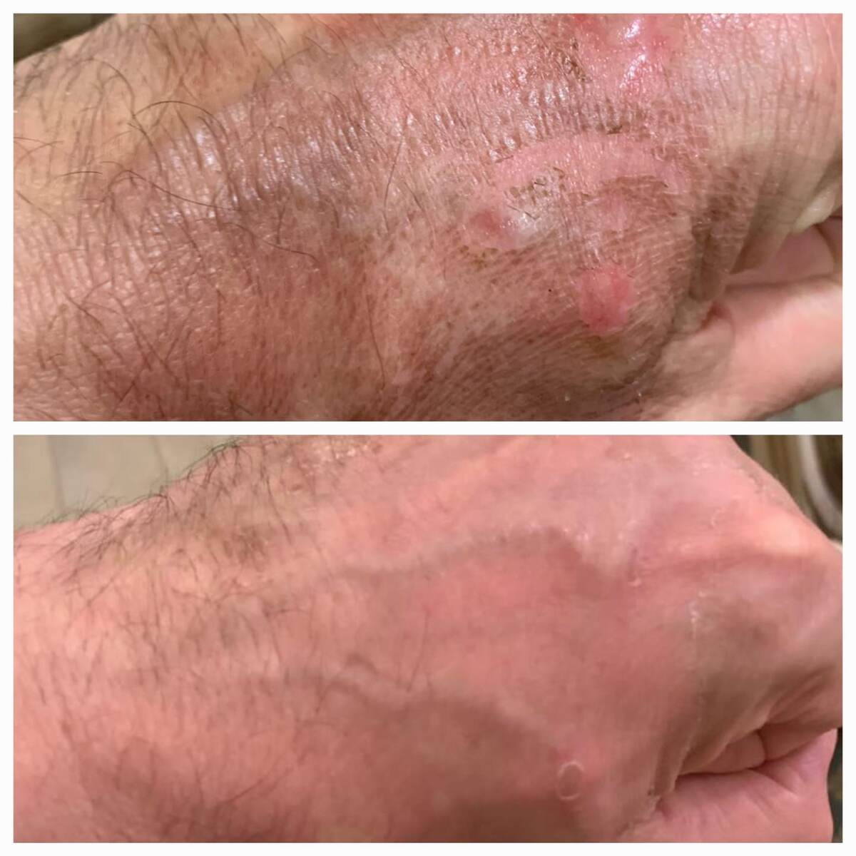 Восстановление при помощи препарата на основе экзосом, Revolution Bio