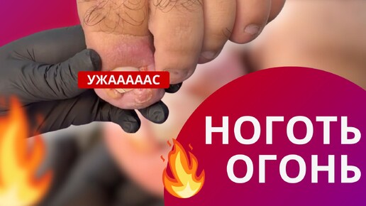 Ноготь ОГОНЬ