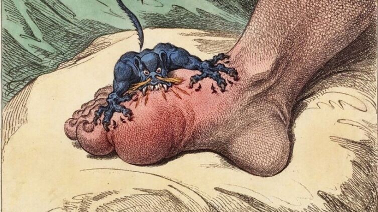    Джеймс Гилрей, «Подагра», 1799 г. Фото: общественное достояние