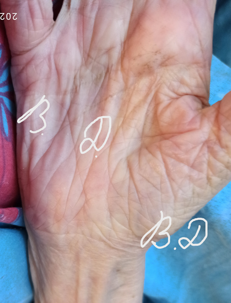 Рука долгожителя хиромантия