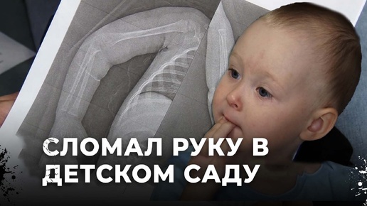 Ребенок сломал руку в частном саду. Почему детский сад скрыл инцидент?