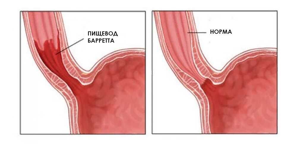 Картинка из открытого источника 
