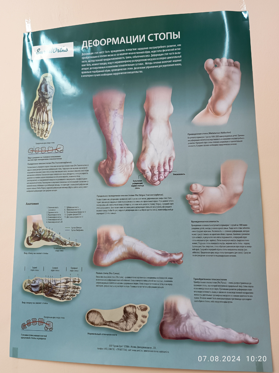 Плакат в кабинете ортопеда.