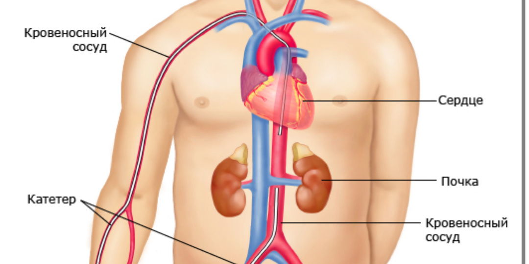 Вам назначили ангиографию? Что это и как к ней подготовиться?