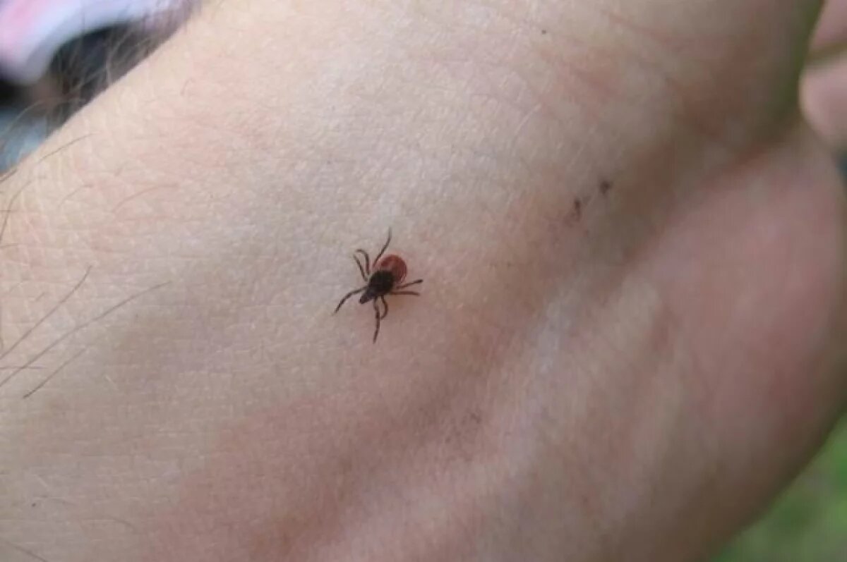    В Томской области от клещей за этот сезон пострадали почти 15 тыс человек