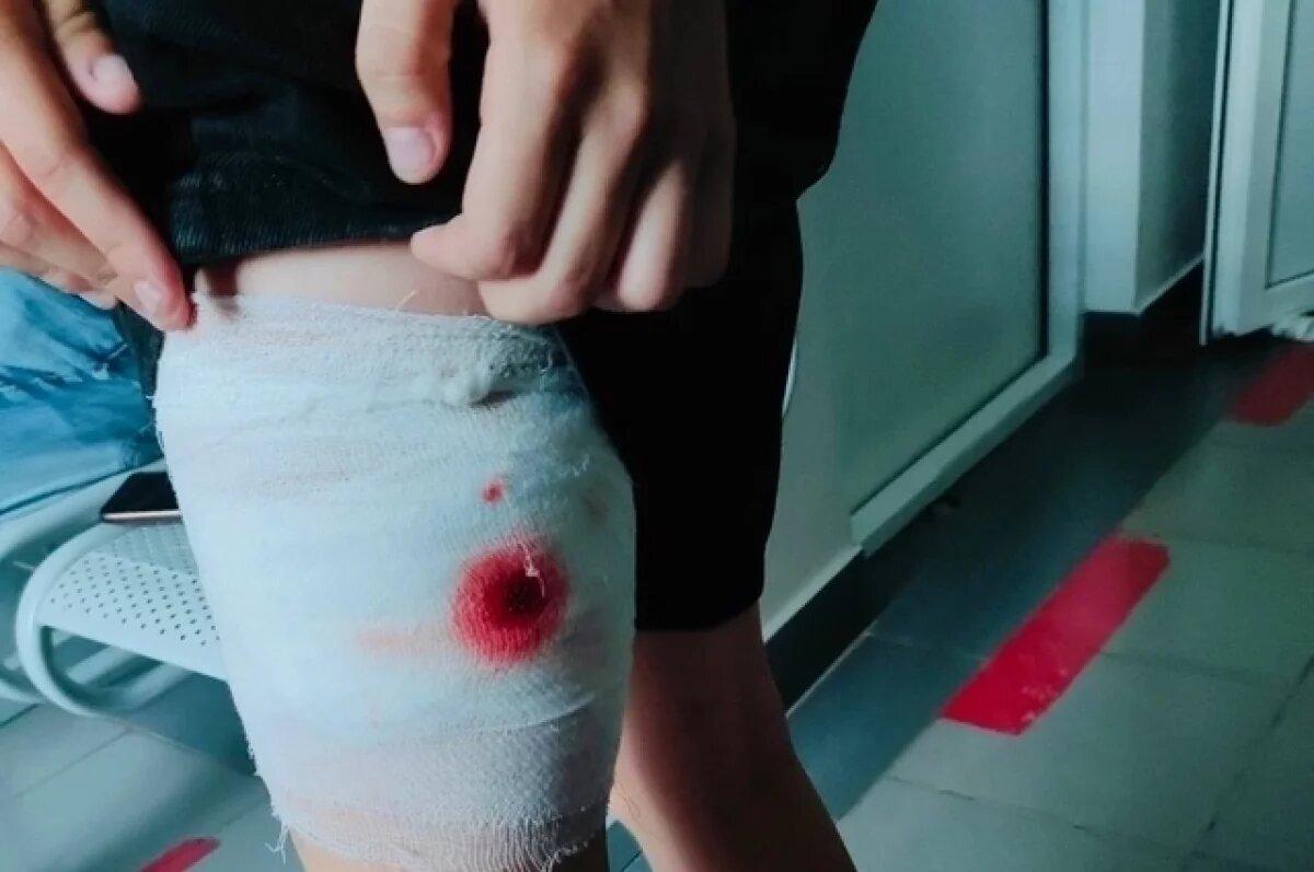    Под Самарой бездомный пёс покусал девочку, заведено уголовное дело