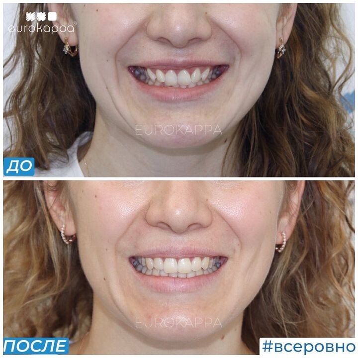 пример лечения: до и после