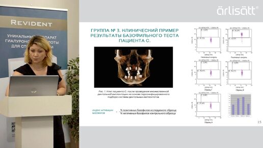 Адаптивный подход к лечению костных дефектов при удалении зубов в хирургической стоматологии