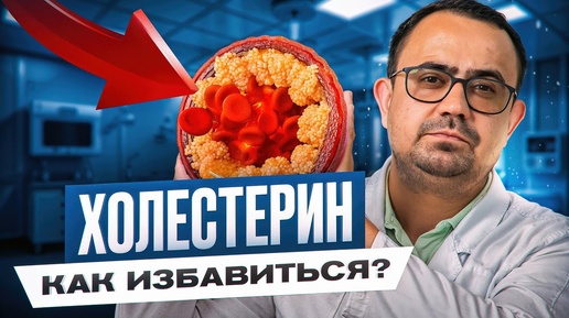 Как очистить сосуды от холестерина БЕЗ таблеток?