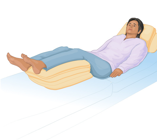 Вас выписывают с диагнозом "тромбоз глубоких вен" - что делать?