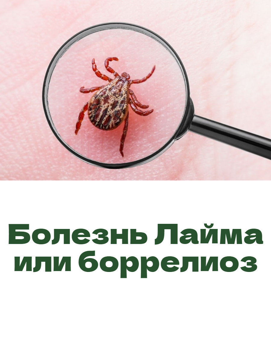 Болезнь Лайма или боррелиоз