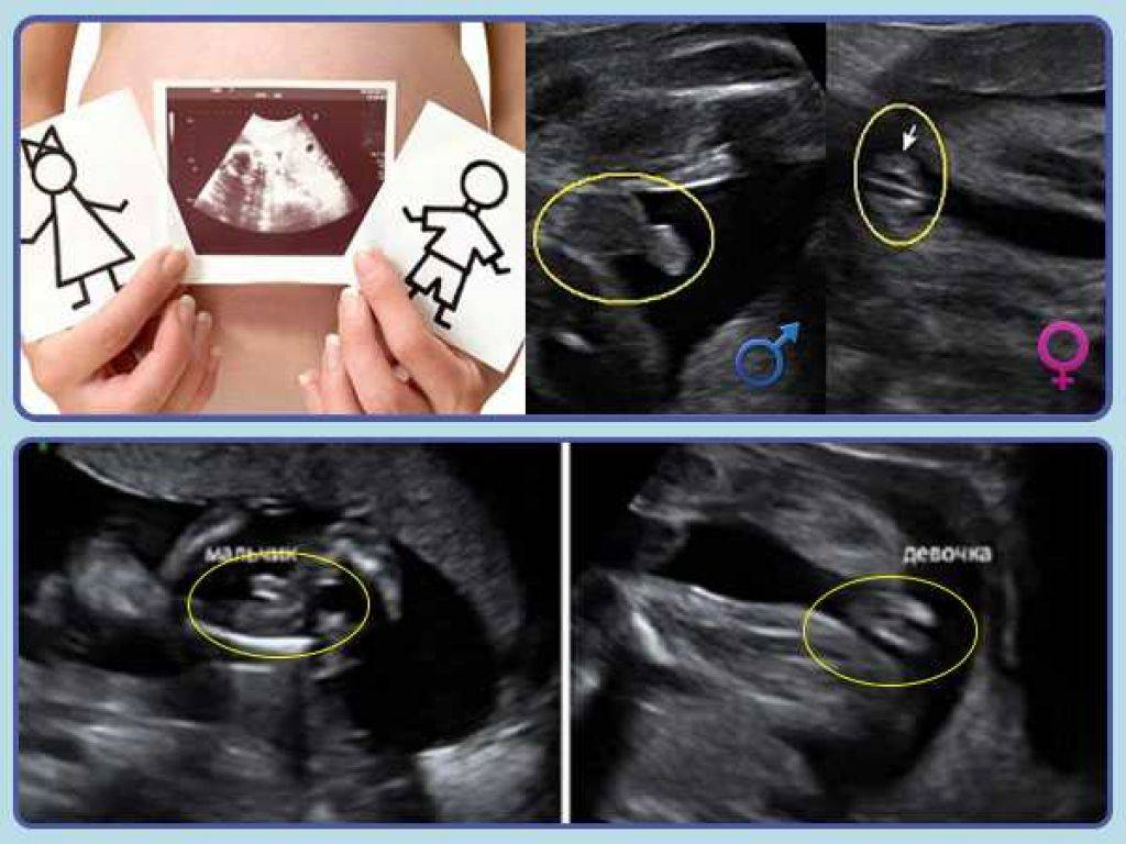 Теперь определить пол у человека становится все труднее