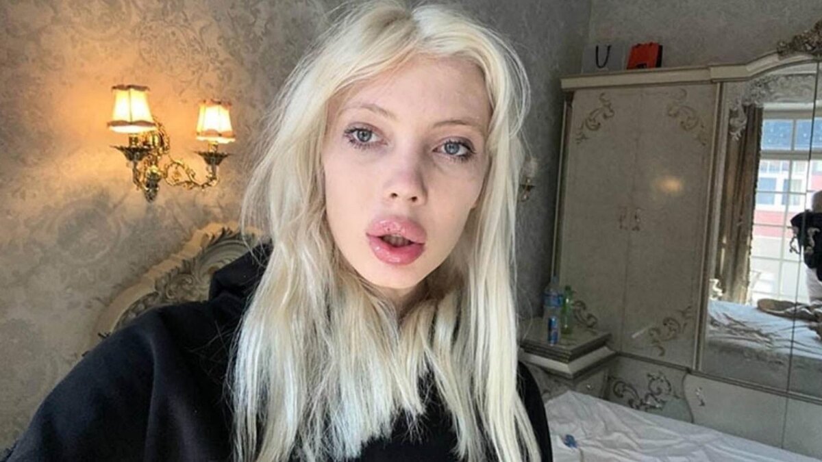 Одна из самых знаменитых наркоблогерш Юлия Финесс. Сейчас проходит принудительное лечение в психиатрической клинике, но есть неподтверждённые данные, что девушка покончила с собой.