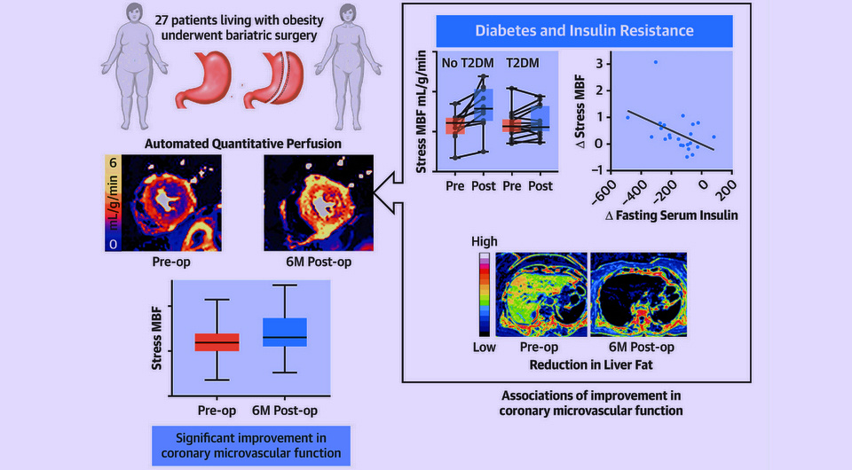   N + 1; James D. Crane et al. / JACC: Cardiovascular Imaging, 2024