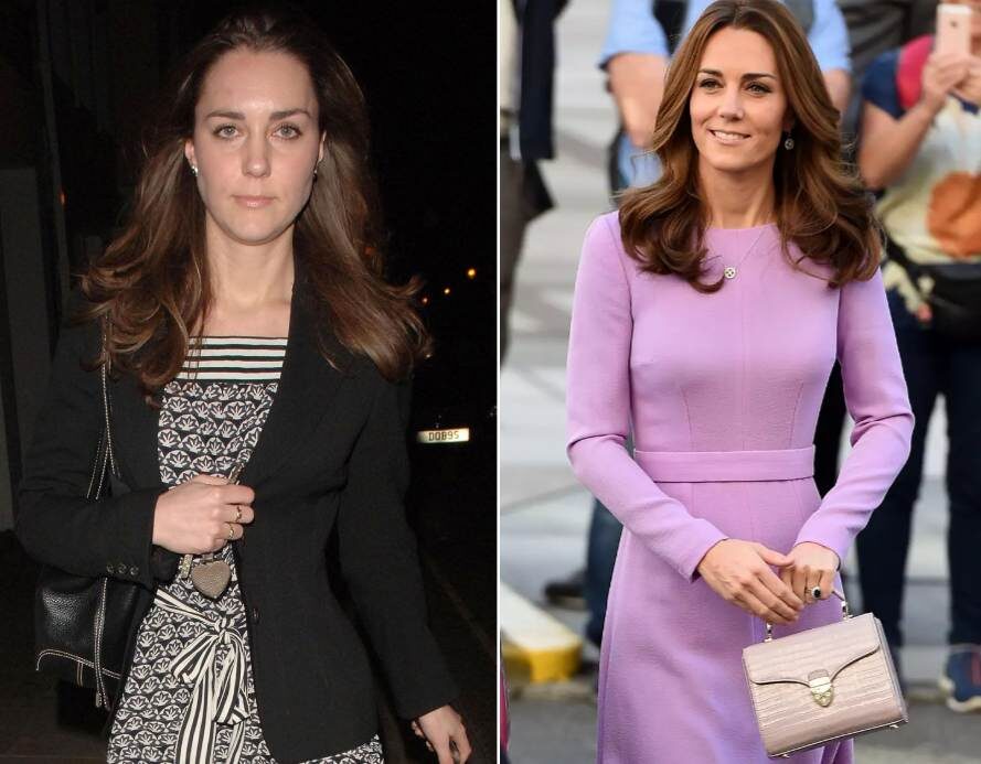 Нос Кейт Миддлтон явно изменил свои очертания после ринопластики. Однако эти перемены деликатны и максимально естественны для внешности принцессы