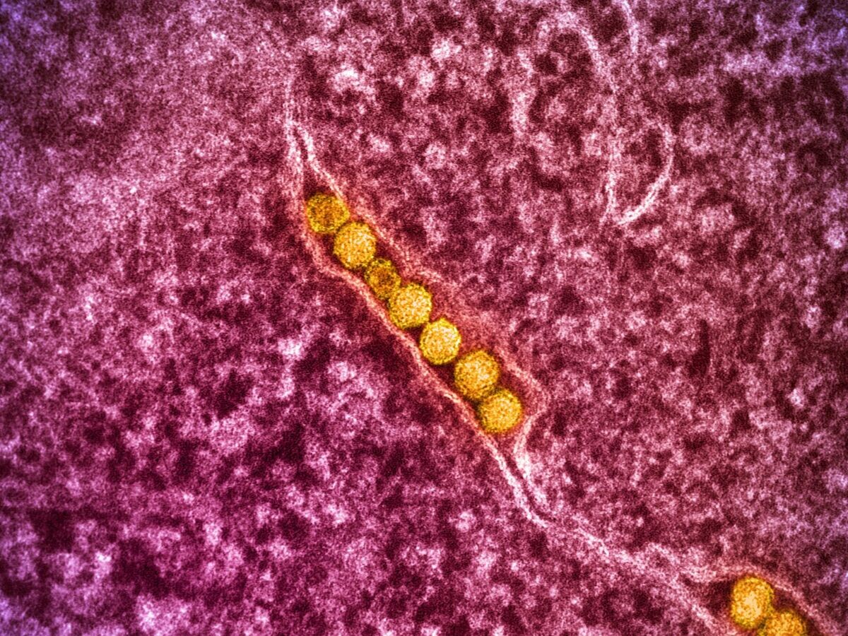    Вирус Западного НилаCC BY 2.0 / NIAID / West Nile Virus