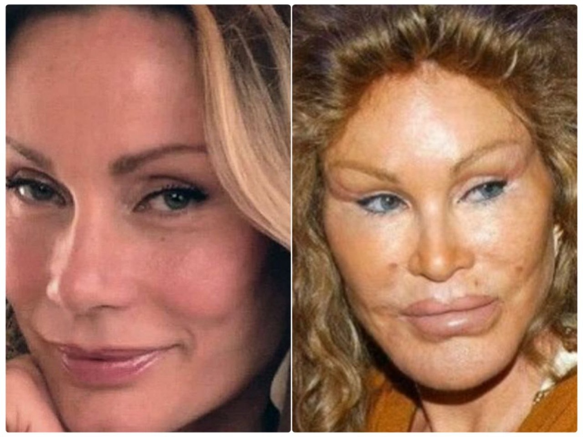 Джоселин Вильденштейн до и после операций