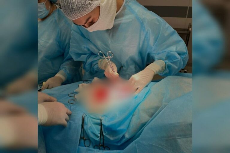    В Оренбурге с начала года прооперировали более 10 девочек с тератомой и кистами Андрей Севостьянов